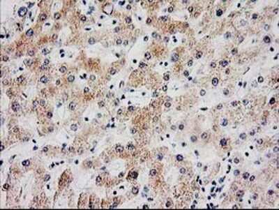 Immunohistochemistry-Paraffin: SERPINB13 Antibody (2B6) [NBP2-01312] Staining of paraffin-embedded Human liver tissue using anti-SERPINB13 mouse monoclonal antibody.