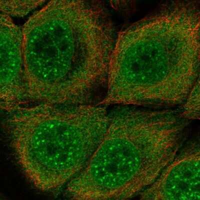 Immunocytochemistry/Immunofluorescence: SERPINB13 Antibody [NBP2-57225] - Staining of human cell line HaCaT shows localization to nuclear speckles & cytosol.