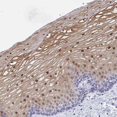 Immunohistochemistry: SERPINB13 Antibody [NBP2-38821] - Staining of human vagina shows nuclear and weak cytoplasmic positivity in squamous epithelial cells.