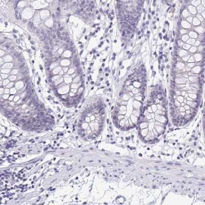 Immunohistochemistry-Paraffin: SERPINB13 Antibody [NBP2-38821] - Staining of human colon shows low expression as expected.
