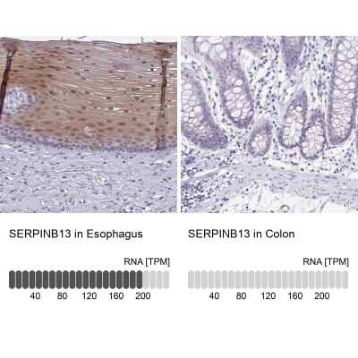 <b>Orthogonal Strategies Validation. </b>Immunohistochemistry-Paraffin: SERPINB13 Antibody [NBP2-38821] - Staining in human esophagus and colon tissues using anti-SERPINB13 antibody. Corresponding SERPINB13 RNA-seq data are presented for the same tissues.