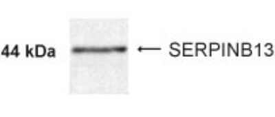 Western Blot: SERPINB13 Antibody [NBP2-24381] - Western blot analysis of SERPINB13 in 5ug of normal oral mucosa lysate using NBP2-24381.
