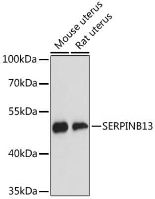 Western Blot: SERPINB13 Antibody [NBP2-94638] - Analysis of extracts of various cell lines, using SERPINB13 at 1:3000 dilution. Secondary antibody: HRP Goat Anti-Rabbit IgG (H+L) at 1:10000 dilution. Lysates/proteins: 25ug per lane. Blocking buffer: 3% nonfat dry milk in TBST. Detection: ECL Basic Kit . Exposure time: 90s.