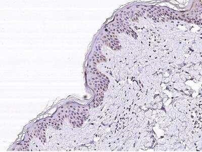 Immunohistochemistry-Paraffin: SERPINB4 Antibody (001) [NBP2-90154] - Immunochemical staining of human SERPINB4 in human skin with rabbit monoclonal antibody (1:200, formalin-fixed paraffin embedded sections).