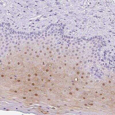 Immunohistochemistry: SERPINB4 Antibody [NBP2-46762] - Staining of human vagina shows moderate cytoplasmic and nuclear positivity in squamous epithelial cells.