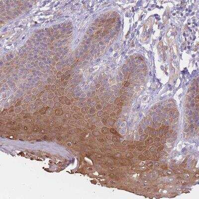 Immunohistochemistry: SERPINB4 Antibody [NBP2-46779] - Staining of human vulva/anal skin shows moderate cytoplasmic and nuclear positivity in epidermal cells.