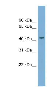 Western Blot: SERPINB4 Antibody [NBP1-57078] - HepG2 cell lysate, concentration 0.2-1 ug/ml.