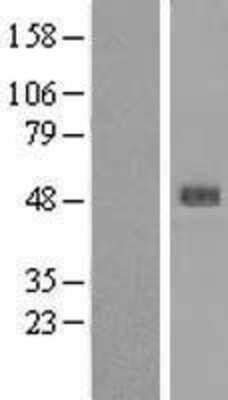 Western Blot: SERPINB4 Overexpression Lysate (Adult Normal) [NBL1-15847] Left-Empty vector transfected control cell lysate (HEK293 cell lysate); Right -Over-expression Lysate for SERPINB4.