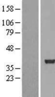 Western Blot: SERTAD2 Overexpression Lysate (Adult Normal) [NBL1-15860] Left-Empty vector transfected control cell lysate (HEK293 cell lysate); Right -Over-expression Lysate for SERTAD2.
