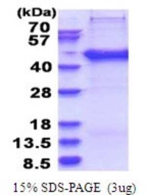 SDS-Page: SERTAD2 Recombinant Protein [NBP2-51773] - 15% SDS Page (3 ug)