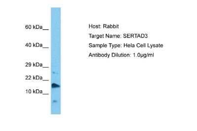 Western Blot: SERTAD3 Antibody [NBP2-83513] - Host: Rabbit. Target Name: SERTAD3. Sample Tissue: Human Hela Whole Cell lysates. Antibody Dilution: 1ug/ml