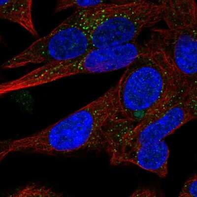 Immunocytochemistry/Immunofluorescence: SERTM1 Antibody [NBP2-30411] - Staining of human cell line SH-SY5Y shows localization to vesicles.