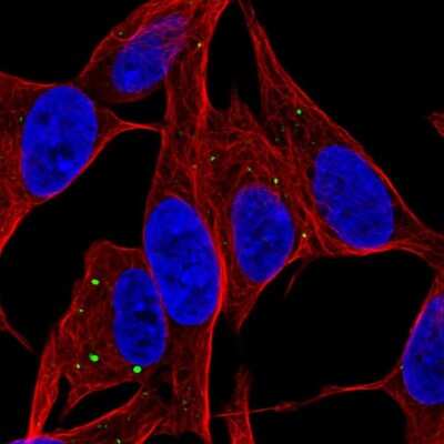 Immunocytochemistry/Immunofluorescence: SERTM1 Antibody [NBP2-57568] - Staining of human cell line SH-SY5Y shows localization to vesicles.