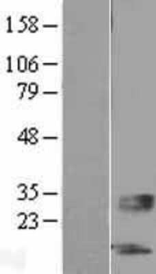 Western Blot: SERTM1 Overexpression Lysate (Adult Normal) [NBL1-08165] Left-Empty vector transfected control cell lysate (HEK293 cell lysate); Right -Over-expression Lysate for SERTM1.