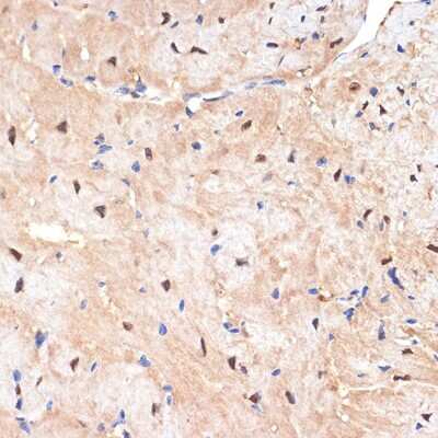 Immunohistochemistry-Paraffin: SESN1 Antibody (7I5Y4) [NBP3-15916] - Immunohistochemistry of paraffin-embedded mouse heart using SESN1 Rabbit mAb (NBP3-15916) at dilution of 1:100 (40x lens).Perform microwave antigen retrieval with 10 mM Tris/EDTA buffer pH 9.0 before commencing with IHC staining protocol.