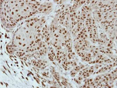 Immunohistochemistry-Paraffin: SESN1 Antibody [NBP2-20316] - Immunohistochemical analysis of paraffin-embedded Cal27 xenograft, using antibody at 1:500 dilution.