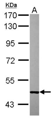 Western Blot: SESN1 Antibody [NBP2-20316] - Sample (30 ug of whole cell lysate) A: HepG2 7. 5% SDS PAGE gel, diluted at 1:1000.