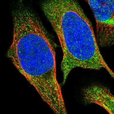 Immunocytochemistry/Immunofluorescence: SESN2 Antibody [NBP1-85029] - Immunofluorescent staining of human cell line U-2 OS shows localization to cytosol.