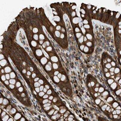 Immunohistochemistry-Paraffin: SESN2 Antibody [NBP1-85029] - Staining of human colon shows strong cytoplasmic positivity in glandular cells.