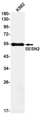 Western Blot: SESN2 Antibody (S05-8C1) [NBP3-19769] - Western blot detection of SESN2 in K562 cell lysates using NBP3-19769 (1:1000 diluted). Predicted band size: 55kDa. Observed band size: 55kDa.