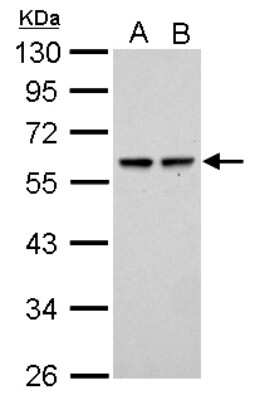 Western Blot: SESN2 Antibody [NBP2-20317] - A. 30 ug Raji whole cell lysate/extract B. 30 ug K562 whole cell lysate/extract10 % SDS-PAGE SESN2 antibody dilution: 1:1000.