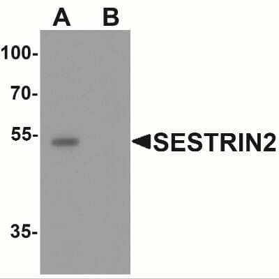 Western Blot: SESN2 Antibody [NBP2-41302] - Western blot analysis of SESTRIN2 in mouse kidney tissue lysate with SESTRIN2 antibody at 1 ug/ml in (A) the absence and (B) the presence of blocking peptide.