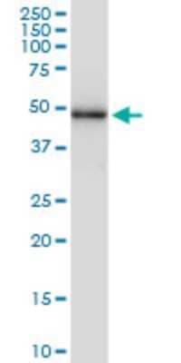 Western Blot: SESN3 Antibody (2C9) [H00143686-M02] - SESN3 monoclonal antibody (M02), clone 2C9. Analysis of SESN3 expression in human pancreas.