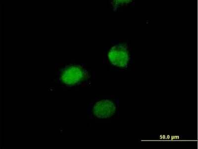 Immunocytochemistry/Immunofluorescence: SESN3 Antibody [H00143686-B01P] - Analysis of purified antibody to SESN3 on HeLa cell. (antibody concentration 10 ug/ml)