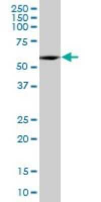 Western Blot: SESN3 Antibody [H00143686-B01P] - Analysis of SESN3 expression in human liver.