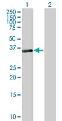 Western Blot: SESN3 Antibody [H00143686-B01P] - Analysis of SESN3 expression in transfected 293T cell line by SESN3 polyclonal antibody.  Lane 1: SESN3 transfected lysate(35.31 KDa). Lane 2: Non-transfected lysate.