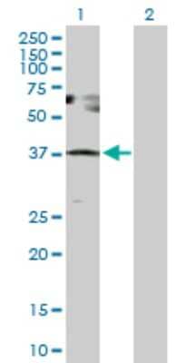 Western Blot: SESN3 Antibody [H00143686-D01P] - Analysis of SESN3 expression in transfected 293T cell line by SESN3 polyclonal antibody.Lane 1: SESN3 transfected lysate(36.60 KDa).Lane 2: Non-transfected lysate.