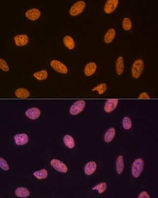 Immunocytochemistry/Immunofluorescence: SET Antibody (8E8M9) [NBP3-16775] - Immunofluorescence analysis of U-2 OS cells using SET Rabbit mAb (NBP3-16775) at dilution of 1:100 (40x lens). Blue: DAPI for nuclear staining.