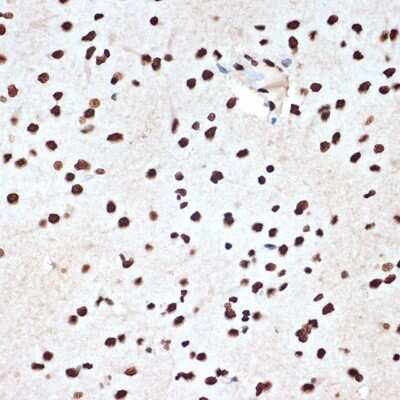 Immunohistochemistry-Paraffin: SET Antibody (8E8M9) [NBP3-16775] - Immunohistochemistry of paraffin-embedded rat brain using SET Rabbit mAb (NBP3-16775) at dilution of 1:100 (40x lens).Perform microwave antigen retrieval with 10 mM Tris/EDTA buffer pH 9.0 before commencing with IHC staining protocol.