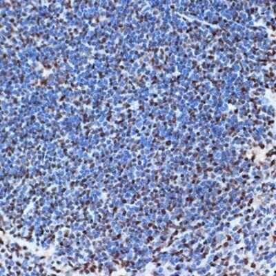 Immunohistochemistry-Paraffin: SET Antibody (8E8M9) [NBP3-16775] - Immunohistochemistry of paraffin-embedded mouse spleen using SET Rabbit mAb (NBP3-16775) at dilution of 1:100 (40x lens).Perform microwave antigen retrieval with 10 mM Tris/EDTA buffer pH 9.0 before commencing with IHC staining protocol.