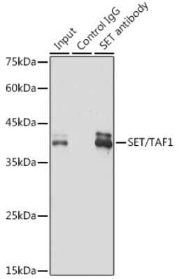 Immunoprecipitation: SET Antibody (8E8M9) [NBP3-16775] - Immunoprecipitation analysis of 300ug extracts of 293T cells using 3ug SET antibody (NBP3-16775). Western blot was performed from the immunoprecipitate using SET antibody (NBP3-16775) at a dilition of 1:1000.