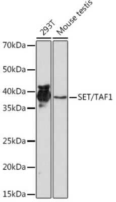 Western Blot: SET Antibody (8E8M9) [NBP3-16775] - Western blot analysis of extracts of various cell lines, using SET Rabbit mAb (NBP3-16775) at 1:1000 dilution. Secondary antibody: HRP Goat Anti-Rabbit IgG (H+L) at 1:10000 dilution. Lysates/proteins: 25ug per lane. Blocking buffer: 3% nonfat dry milk in TBST. Detection: ECL Basic Kit. Exposure time: 10s.