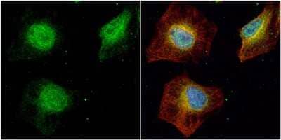 Immunocytochemistry/Immunofluorescence: SET Antibody [NBP1-33713] - SET antibody detects SET protein at cytoplasm and nucleus by immunofluorescent analysis. Sample: HeLa cells were fixed in 4% paraformaldehyde at RT for 15 min. Green: SET protein stained by SET antibody diluted at 1:500. Red: alpha Tubulin, a cytoskeleton marker, stained by alpha Tubulin antibody diluted at 1:1000. Blue: Hoechst 33342 staining.