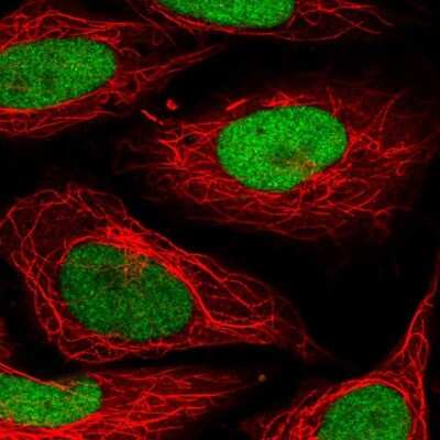 Immunocytochemistry/Immunofluorescence: SET Antibody [NBP2-38031] - Staining of human cell line SiHa shows localization to nucleoplasm. Antibody staining is shown in green.