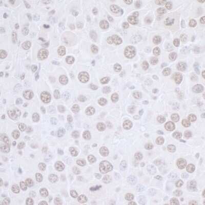 <b>Biological Strategies Validation. </b>Immunohistochemistry: SET Antibody [NBP1-26646] - Sample: FFPE section of mouse renal cell carcinoma. Antibody: Affinity purified rabbit anti- SET used at a dilution of 1:1,000 (0.2ug/ml). Detection: DAB