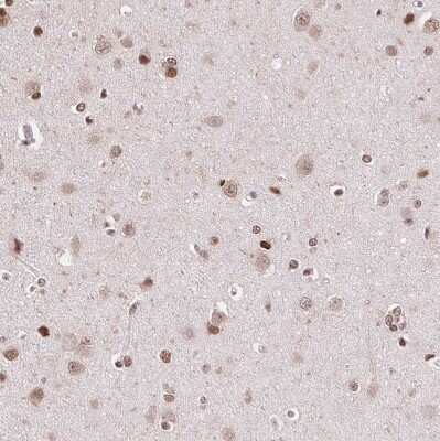 Immunohistochemistry-Paraffin: SET Antibody [NBP2-38031] - Staining of human cerebral cortex shows moderate nuclear positivity in neurons.