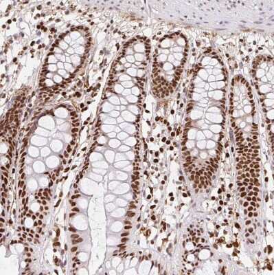 Immunohistochemistry-Paraffin: SET Antibody [NBP2-38031] - Staining of human colon shows very strong nuclear positivity in glandular cells.