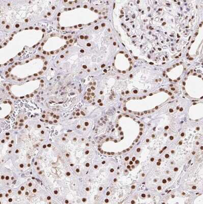 Immunohistochemistry-Paraffin: SET Antibody [NBP2-38031] - Staining of human kidney shows strong nuclear positivity in cells in tubules.