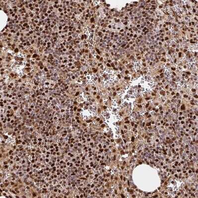 Immunohistochemistry-Paraffin: SET Antibody [NBP2-38031] - Staining of human lymph node shows very strong nuclear positivity in non-germinal center cells.