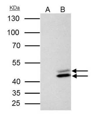 Immunoprecipitation: SET Antibody [NBP1-33713] - SET antibody immunoprecipitates SET protein in IP experiments. IP samples: HeLa whole cell extract. A. Control with 4 ug of preimmune Rabbit IgG. B. Immunoprecipitation of SET protein by 4 ug SET antibody. 10 % SDS-PAGE. The immunoprecipitated SET protein was detected by SET antibody diluted at 1:500.