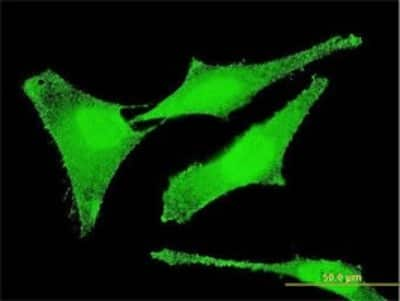 Immunocytochemistry/Immunofluorescence: SET Antibody (M1-F5) [H00006418-M01] - Analysis of monoclonal antibody to SET on HeLa cell . Antibody concentration 10 ug/ml.