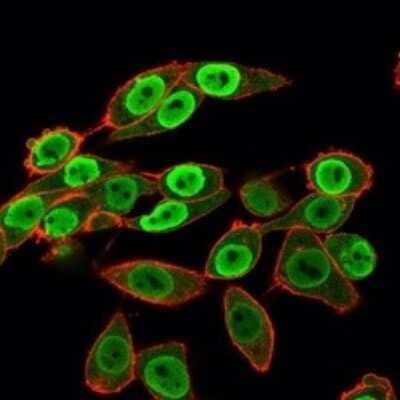 Immunocytochemistry/Immunofluorescence: SET Antibody (PCRP-SET-1C6) [NBP3-07837] - Immunofluorescence Analysis of HeLa cells using SET Mouse Monoclonal Antibody (PCRP-SET-1C6) followed by goat anti- Mouse IgG-CF488 (green). CF640A phalloidin (red).