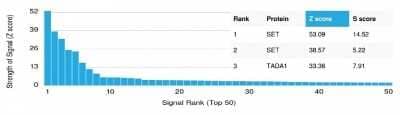 Protein Array: SET Antibody (PCRP-SET-1C6) [NBP3-07837] - Analysis of Protein Array containing more than 19,000 full-length human proteins using SET Mouse Monoclonal Antibody (PCRP-SET-1C6).