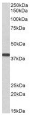 Western Blot: SET Antibody [NB100-817] - Staining (03ug/ml) of Human Kidney lysate (35ug protein in RIPA buffer). Primary incubation was 1 hour. Detected by chemiluminescence.