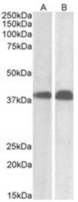 Western Blot: SET Antibody [NB100-817] - Staining (0.01 ug/ml) of Daudi (A) and Molt4 (B) cell lysate (35ug protein in RIPA buffer). Primary incubation was 1 hour. Detected by chemiluminescence.