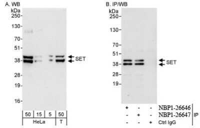 <b>Independent Antibodies Validation and Biological Strategies Validation.</b>Western Blot: SET Antibody [NBP1-26646] - Whole cell lysate from HeLa and 293T cells. SET was also immunoprecipitated by rabbit anti-SET antibody NBP1-26647.